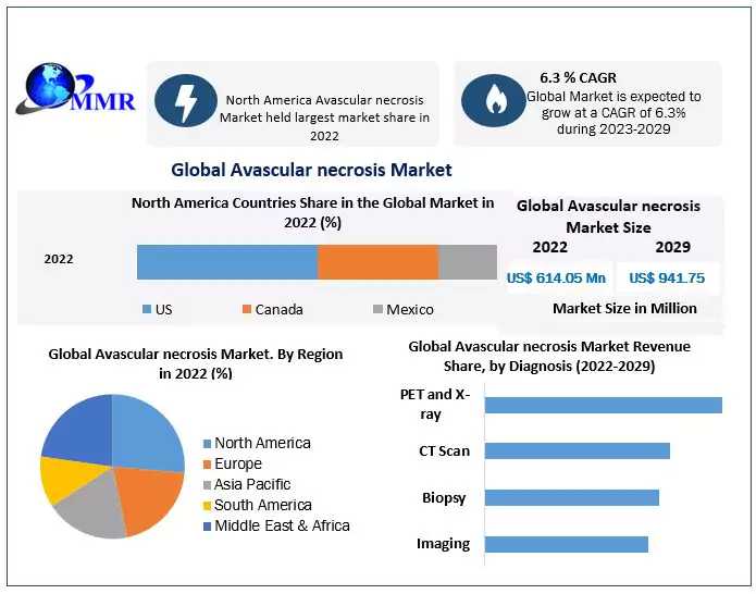 Avascular Necrosis Market Business Outlook And Innovative Trends New Developments, Emerging Opportunities, Upcoming Products Demand 2029