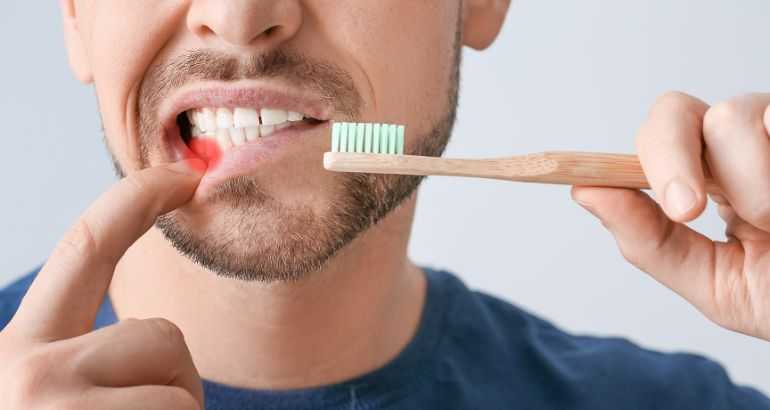 Bleeding Gum Treatment In Chandigarh: Expert Solutions For Optimal Oral Health