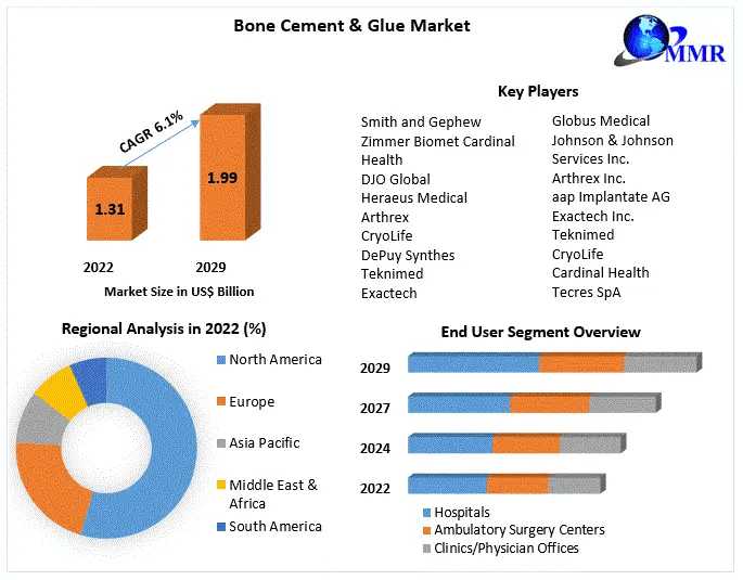 Bone Cement & Glue Market Future Frontiers: Charting Market Size, Share, And Promising Growth Trajectories | 2023-2029