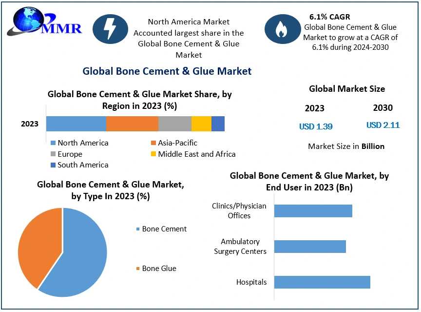 Bone Cement & Glue Market To Reach USD 2.11 Billion By 2030, Growing At 6.1% CAGR