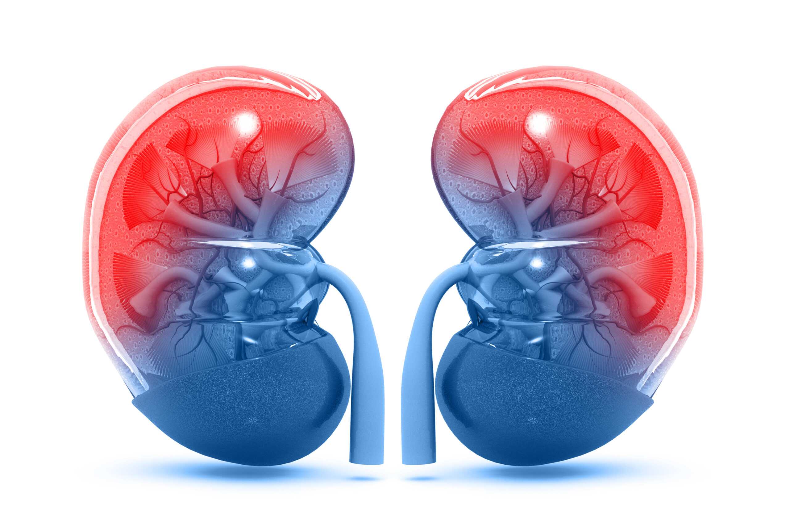 Crush The Pain: Effective Kidney Stone Treatment In Bangalore