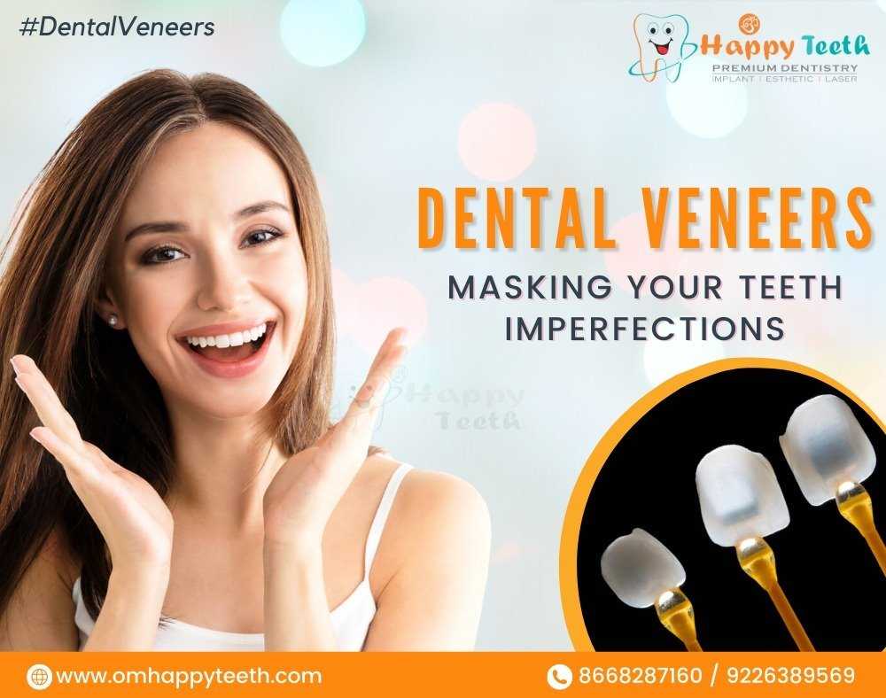 Dental Veneers Masking Your Teeth Imperfections - The Ultimate Guide