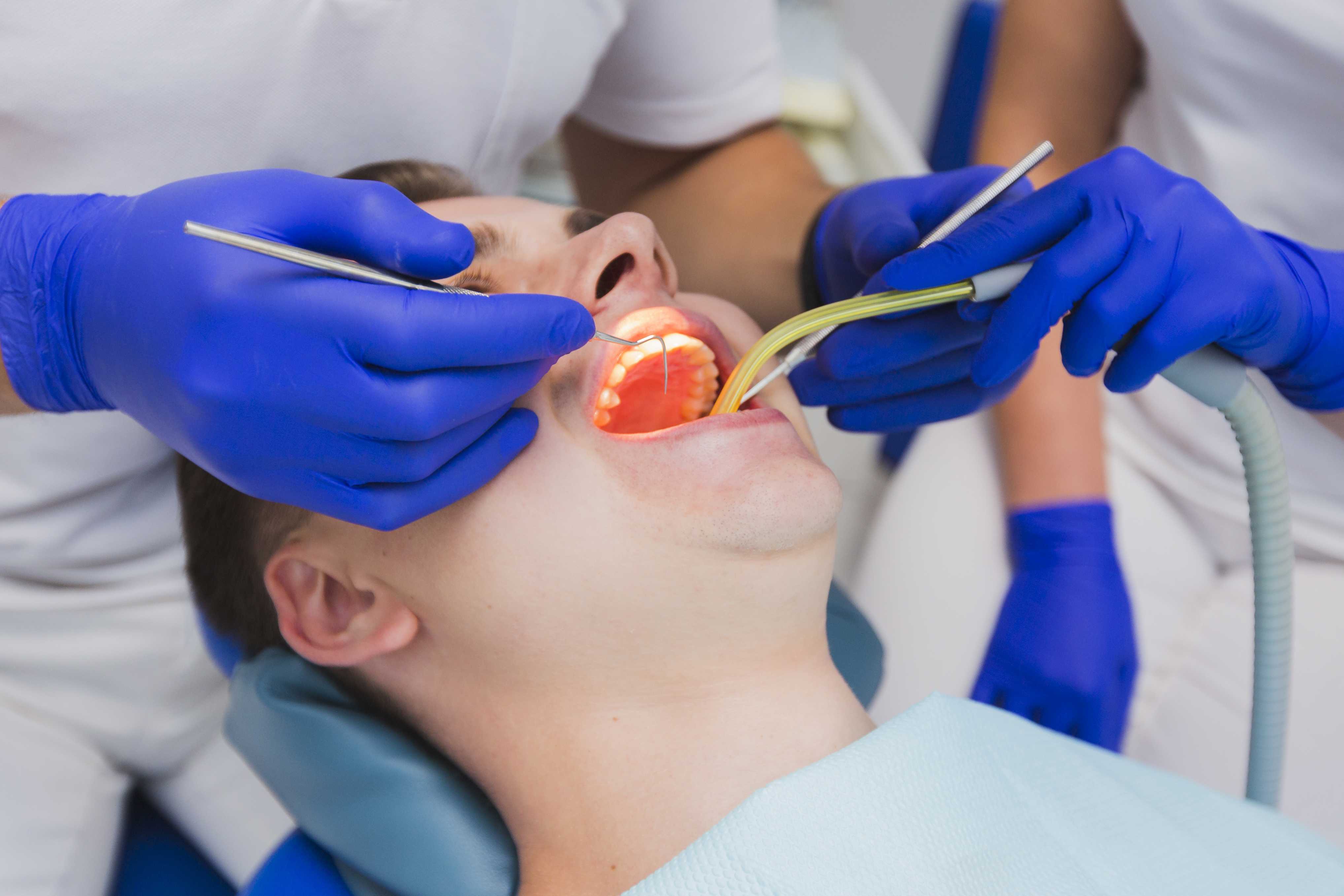 Finding The Best Doctor For Root Canal Treatment At Smile Care India