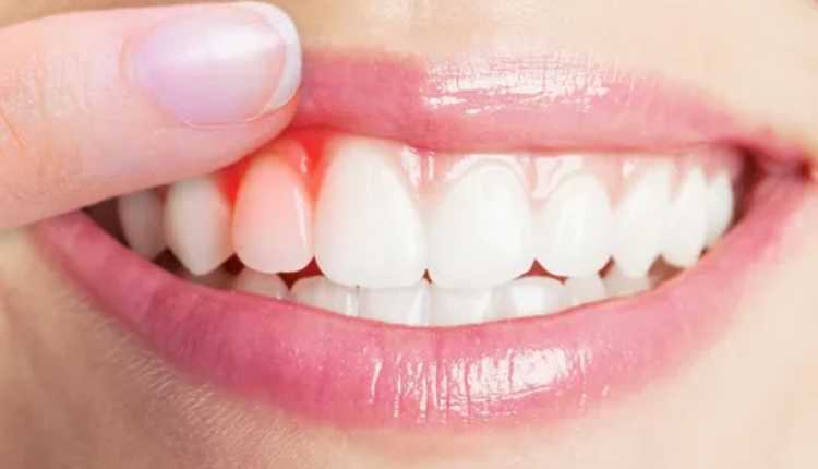 Finding The Best Gums Treatment Doctors In Badlapur: A Comprehensive Guide
