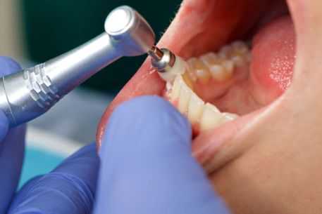 How Do I Choose The Right Dental Clinic In Rajahmundry For Me And My Family?