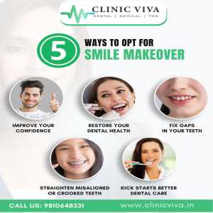 5 Ways To Opt For A Smile Makeover