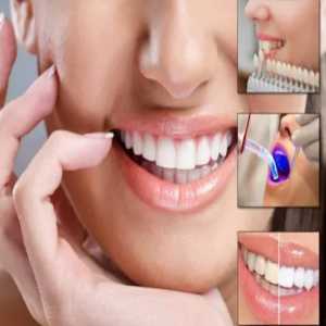Achieve Your Dream Smile With Cosmetic Dental Treatment In Madhapur