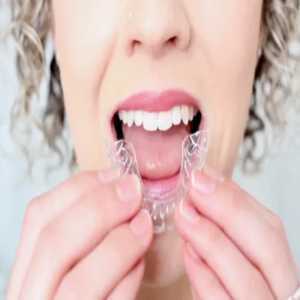 Achieving A Confident Smile With Invisible Braces In Badlapur