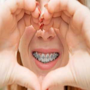 Braces And Jaw Clicking: Managing TMJ Symptoms