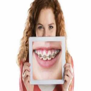 Braces Treatment In Nizamabad: Transforming Smiles With Confidence