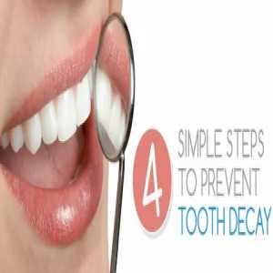Cavity-Free Smiles: Expert Tips For Preventing Tooth Decay