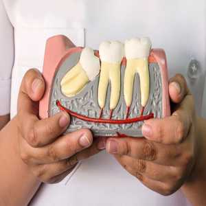 Comprehensive Guide To Painless Wisdom Tooth Extraction In Mulund East