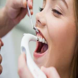 Explore Teeth Whitening Methods, Types, And Potential Side Effects