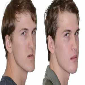 Exploring The Benefits Of Jaw Reconstruction Surgery In Aurangabad