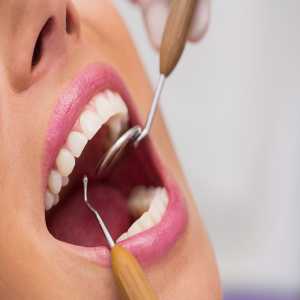 Exploring The Types Of Dental Treatment
