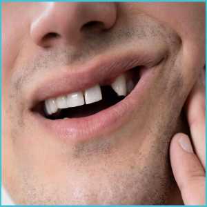 From Implants To Dentures: Missing Tooth Solutions In Pondicherry