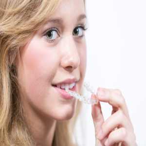 Invisalign For Teens: A Parent's Guide To Clear Aligners (Amma Naana Dental Clinic)