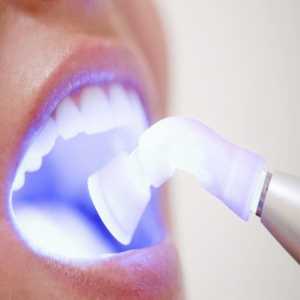 Laser Dental Treatment In Pimple Saudagar, Pune