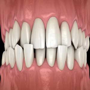 Malocclusion Market Upcoming Trends And Regional Forecast By 2031