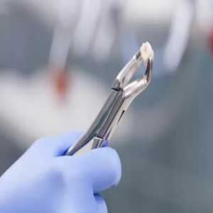 Mastering Comfort: The Art Of Wisdom Tooth Extraction In Chembur East