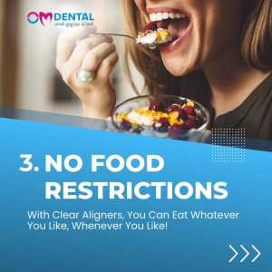 No Food Restrictions - Om Dental Clinic, Nagpur