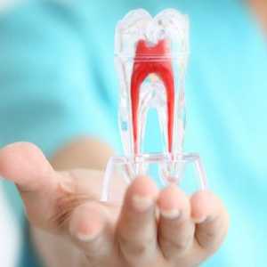 Pain Management In Root Canal Treatment