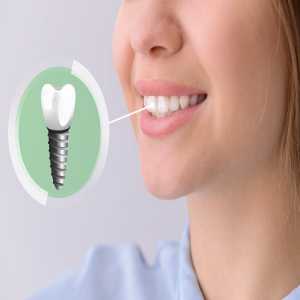 Reclaiming Your Smile: Exploring Dental Implant Treatment In Dombivli