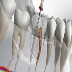 Revitalize Your Smile: Comprehensive Root Canal Treatment In Nerul