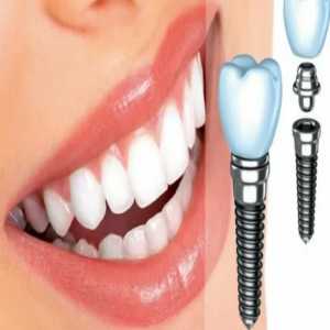Revitalize Your Smile: Dental Implant Treatment In Dattawadi Pune