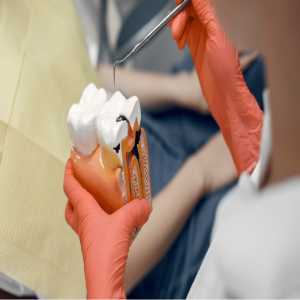 Root Canal Treatment In Bilaspur At Rai Dental Clinic: Your Ultimate Guide