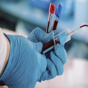 Safeguarding Blood: The Vital Role Of The Blood Screening Market