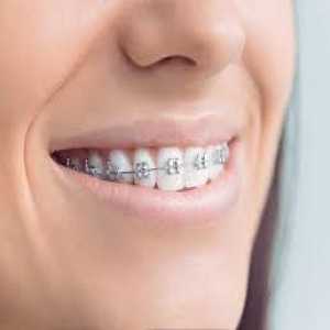 Straighten Your Smile: Exploring Braces Treatment In Dombivli