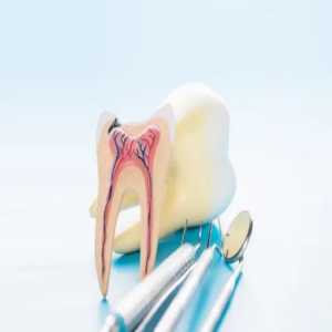 The Advantages Of Single Sitting Root Canal Treatment In Nizamabad