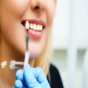 The Impact Of Dental Implants On Your Oral And Overall Health