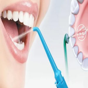 The Importance Of Teeth Cleaning In Madhapur: A Comprehensive Guide