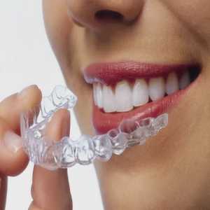 The Price Of A Perfect Smile: A Look At Clear Aligner Treatment Costs In Jamshedpur
