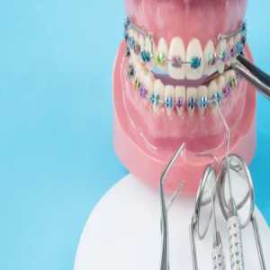 Transform Your Smile: Orthodontics Treatment In Chembur East