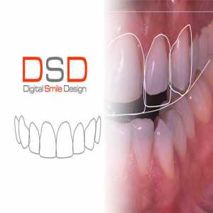 Transform Your Smile With Digital Smile Designing In Mulund East