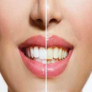 Ultimate Guide To Achieving The Perfect Smile Makeover
