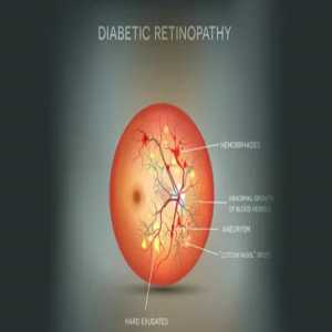 Understanding Diabetic Retinopathy Treatment In Chinchwad: A Comprehensive Guide