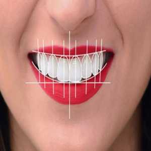 Unveiling Your Dream Smile: A Guide To Digital Smile Design In Dattawadi, Pune