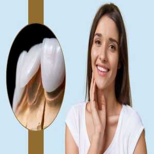 Veneers Smile Makeover: The Secret To A Celebrity Smile