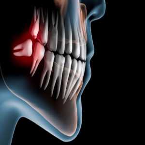 Your Path To Wisdom: Comfortable Wisdom Tooth Removal In Nagpur