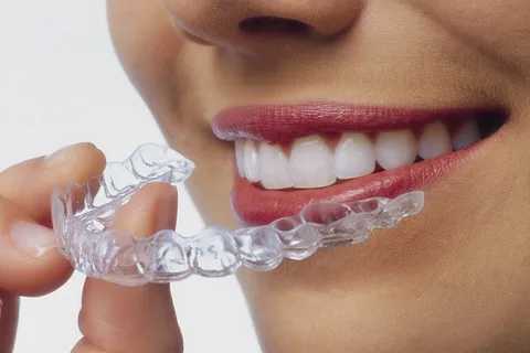 The Price Of A Perfect Smile: A Look At Clear Aligner Treatment Costs In Jamshedpur