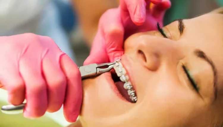 Transform Your Smile: Choosing The Best Orthodontist In Thakur Village