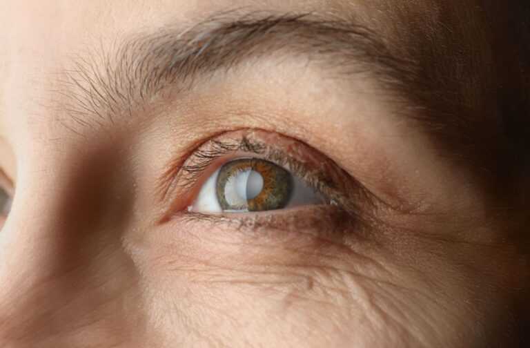 Types Of Glaucoma Surgery: Which Procedure Is Best For You?