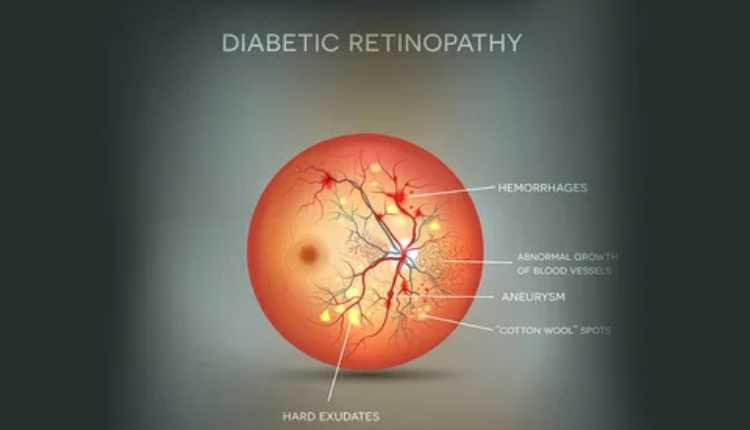 Understanding Diabetic Retinopathy Treatment In Chinchwad: A Comprehensive Guide