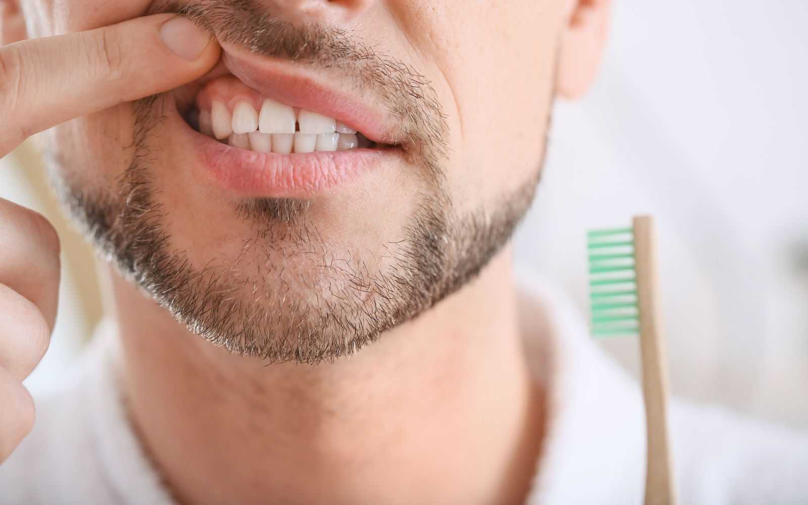 Understanding Gum Bleeding When Brushing Teeth