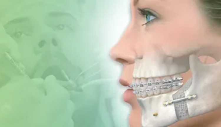 Unveiling The Best Oral And Maxillofacial Surgeons In Aurangabad